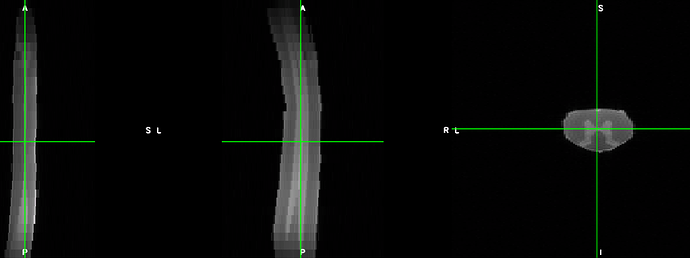 t2_coronal