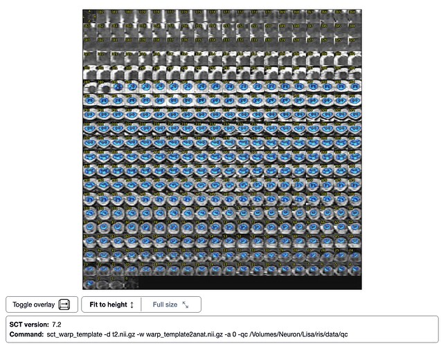 sct_warp_template - T2w