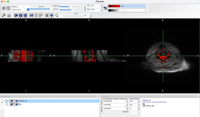 Warped_T2templated_higherMinValue
