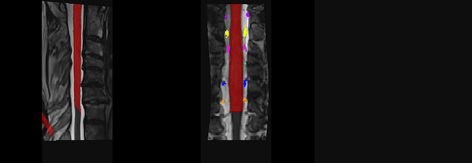 sct_registration_rootlets