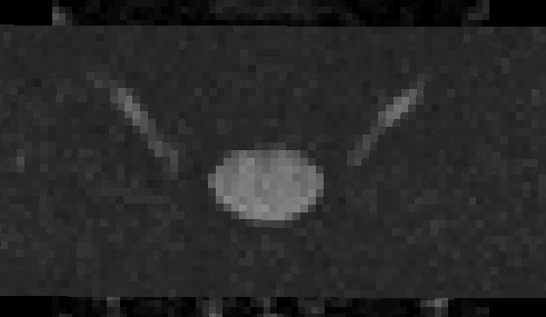 ezgif.com-animated-gif-maker(3)