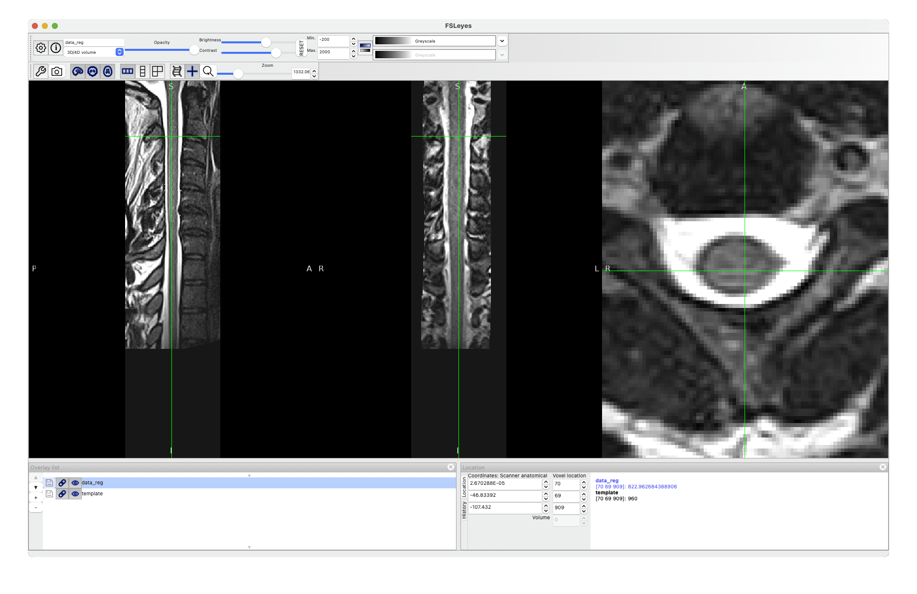 ezgif-5e000ab978671871